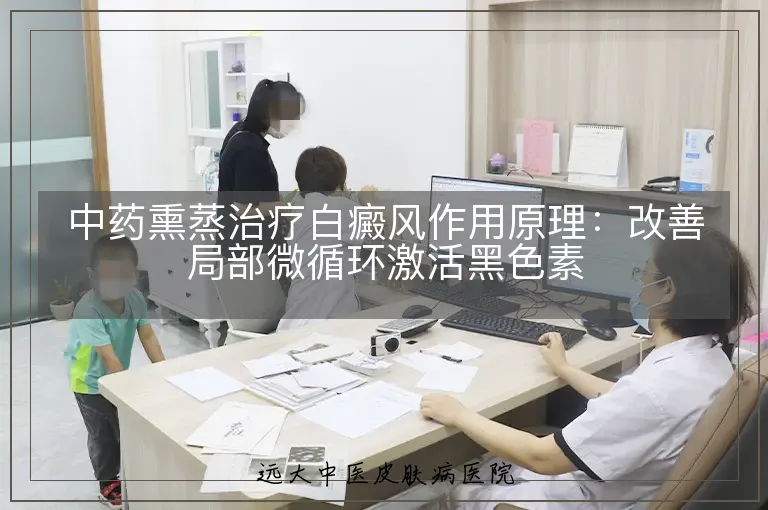 中药熏蒸治疗白癜风作用原理:改善局部微循环激活黑色素