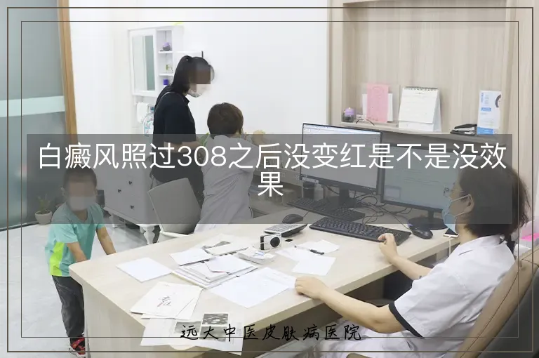白癜风照过308之后没变红是不是没效果