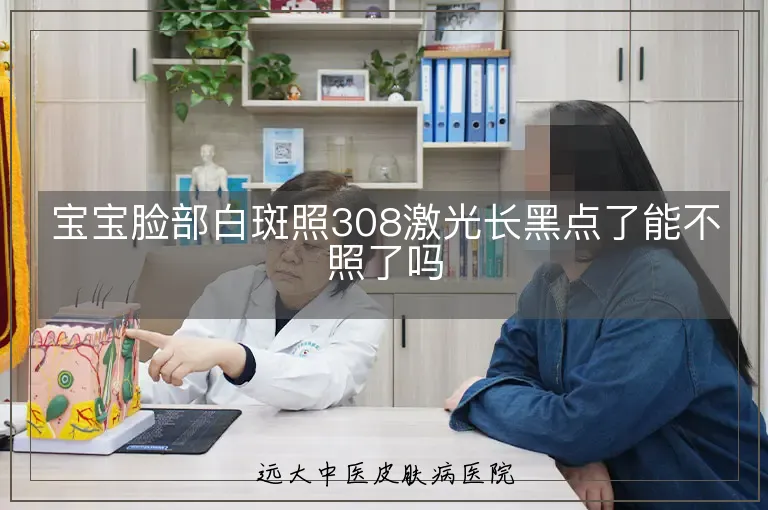 宝宝脸部白斑照308激光长黑点了能不照了吗