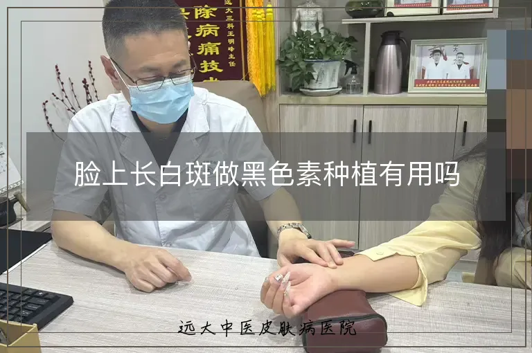 脸上长白斑做黑色素种植有用吗