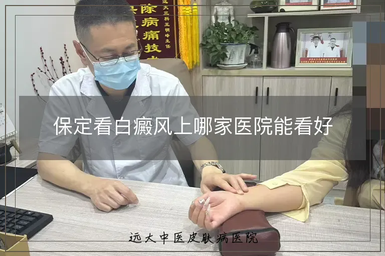 保定看白癜风上哪家医院能看好