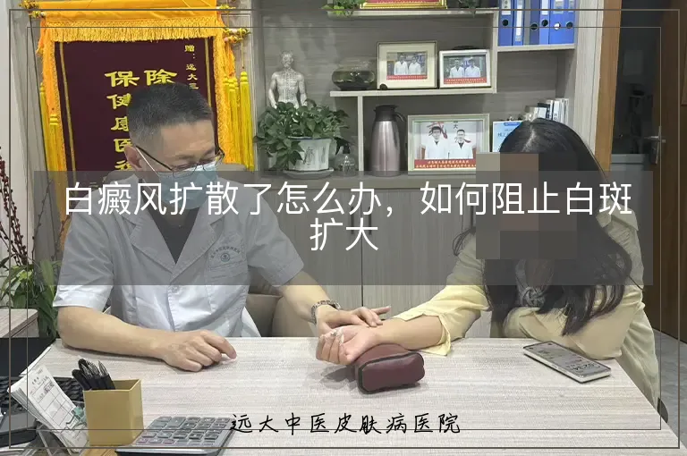 白癜风扩散了怎么办,如何阻止白斑扩大