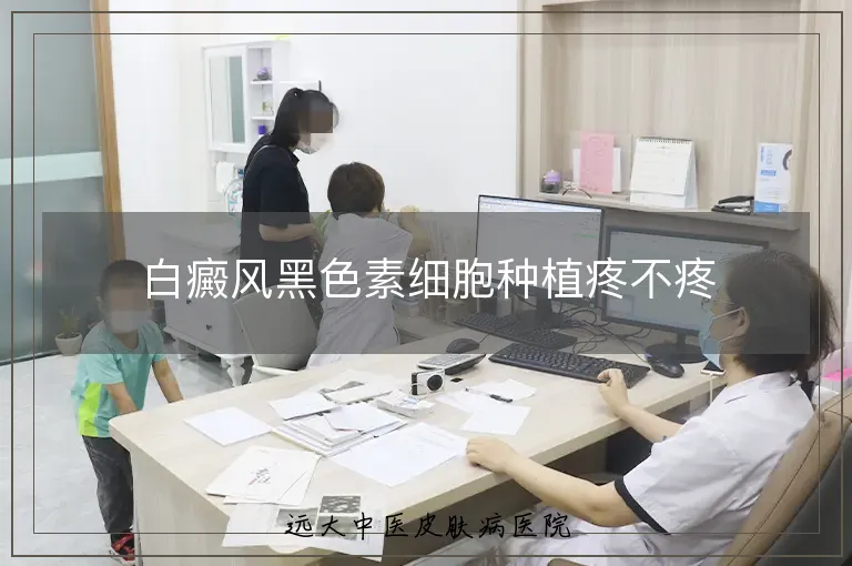 白癜风黑色素细胞种植疼不疼