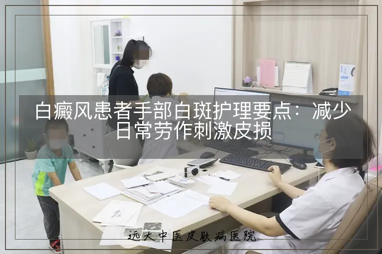 白癜风患者手部白斑护理要点:减少日常劳作刺激皮损