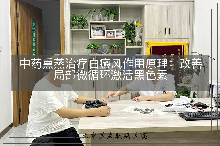 中药熏蒸治疗白癜风作用原理:改善局部微循环激活黑色素