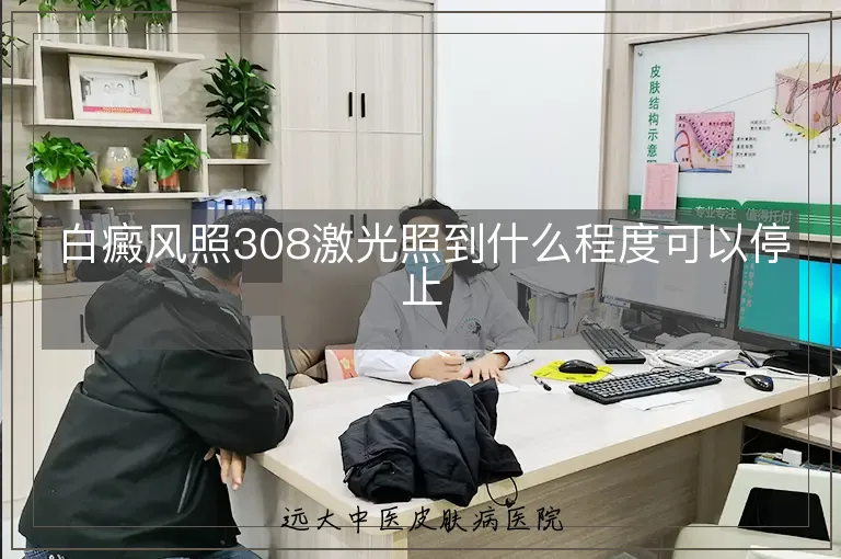 白癜风照308激光照到什么程度可以停止