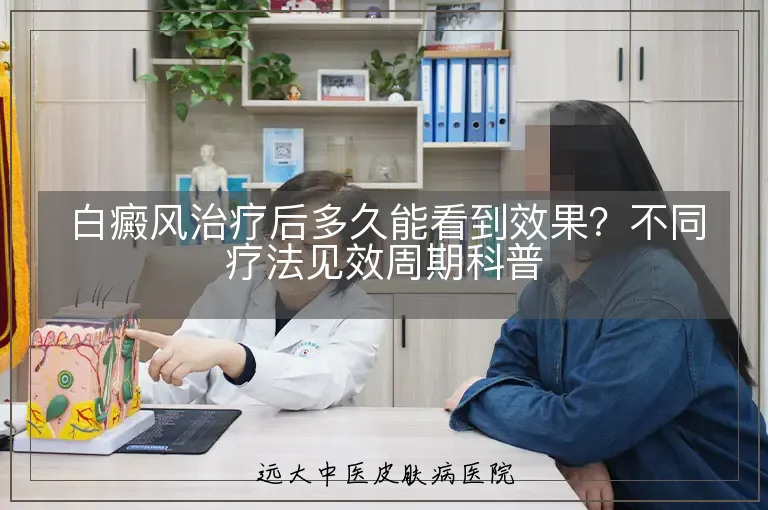 白癜风治疗后多久能看到效果?不同疗法见效周期科普