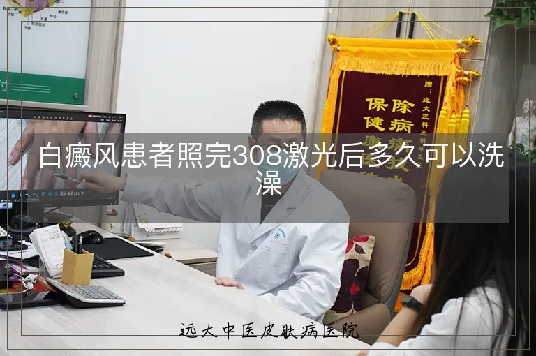 白癜风患者照完308激光后多久可以洗澡