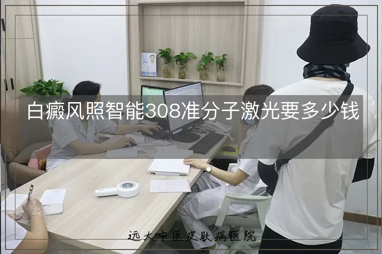 白癜风照智能308准分子激光要多少钱