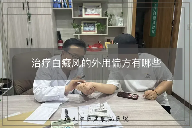 治疗白癜风的外用偏方有哪些