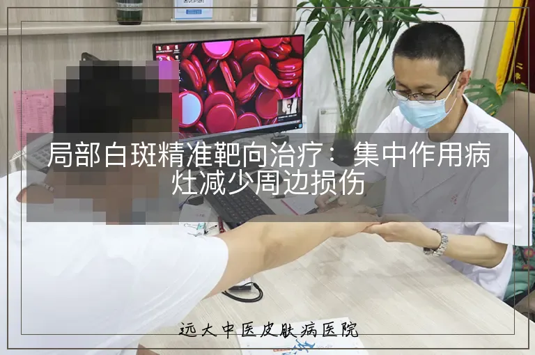 局部白斑精准靶向治疗:集中作用病灶减少周边损伤