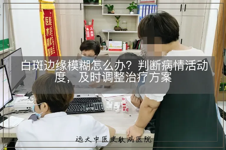 白斑边缘模糊怎么办?判断病情活动度,及时调整治疗方案