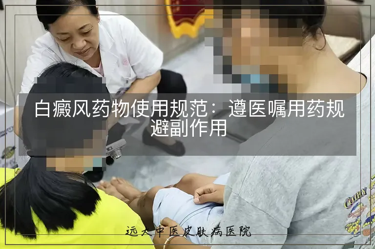 白癜风药物使用规范：遵医嘱用药规避副作用