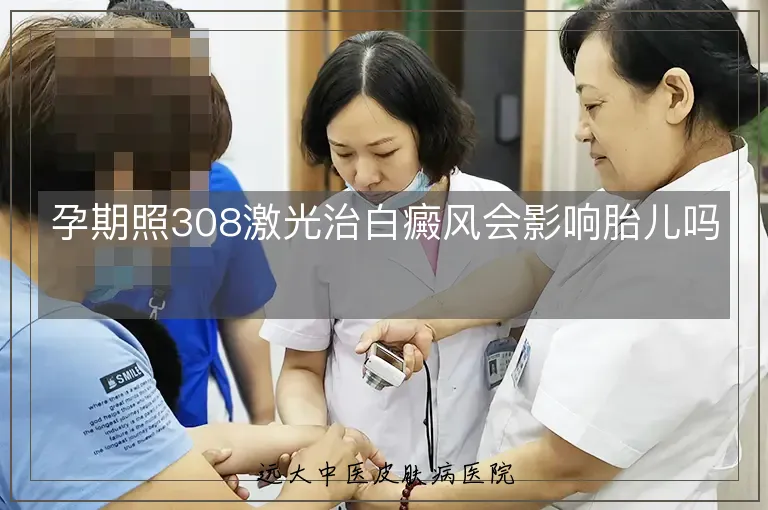 孕期照308激光治白癜风会影响胎儿吗