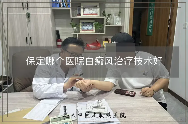 保定哪个医院白癜风治疗技术好