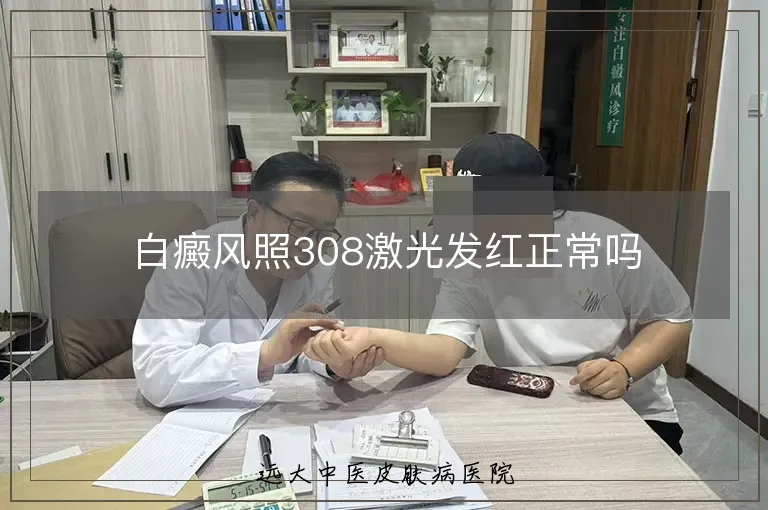 白癜风照308激光发红正常吗