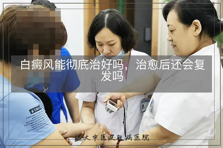 白癜风能彻底治好吗,治愈后还会复发吗
