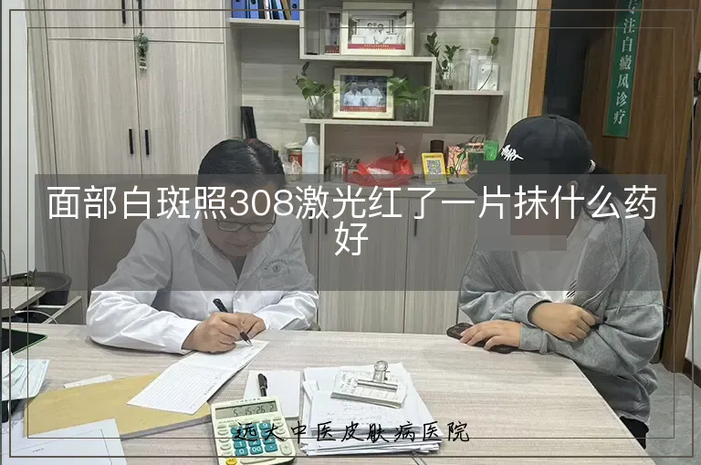 面部白斑照308激光红了一片抹什么药好